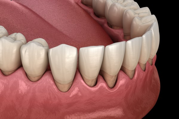 How Gum Disease Treatment Restores Oral Health And Confidence
