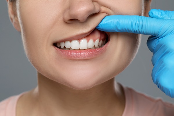 Treatment Options For Gum Recession