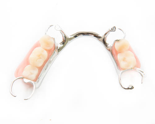 Tooth Replacement With Partial Dentures