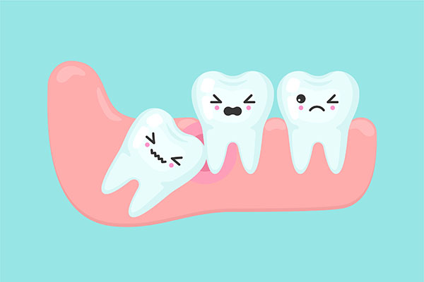 Possible Dental Issues From Wisdom Teeth Cysts
