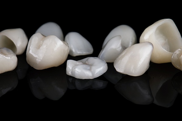 Reasons To Consider Same Day Crowns To Restore Your Smile