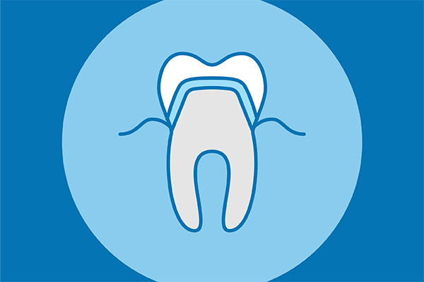 The Advantages Of Custom Made CEREC Crowns